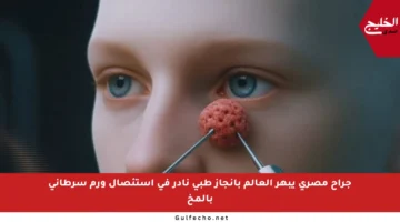 جراح مصري يبهر العالم بإنجاز طبي نادر في استئصال ورم سرطاني بالمخ